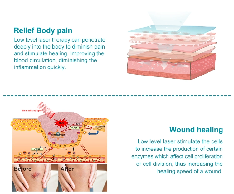 Infrared Light Therapy Cold Laser Therapy Device for Pain Relief